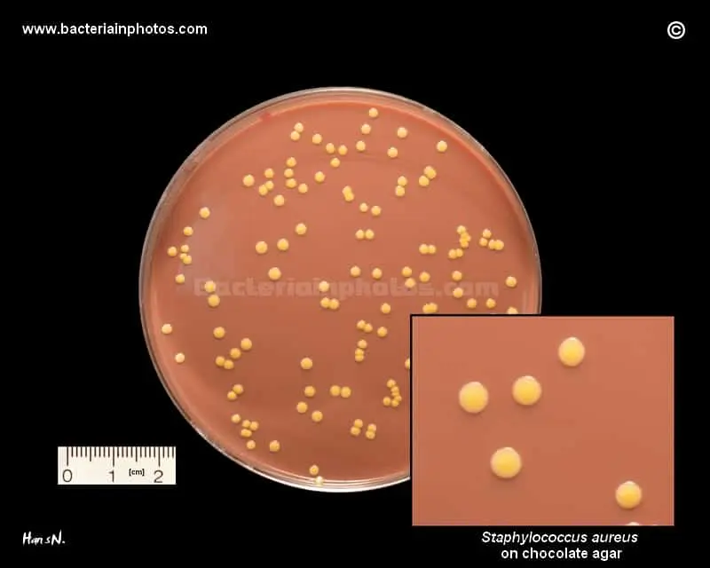 Staphylococcus Aureus Lab Testing
