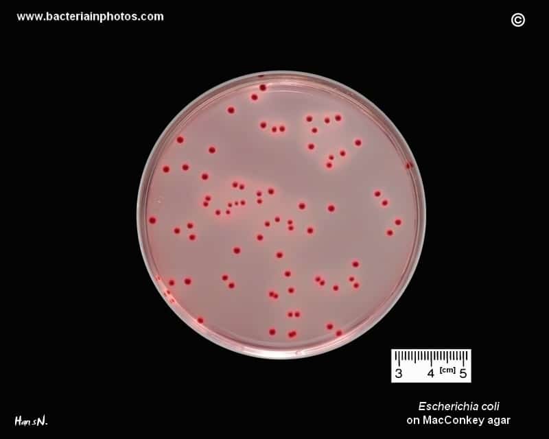 Escherichia coli lab testing