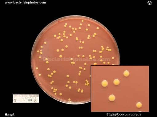 Staphylococcus